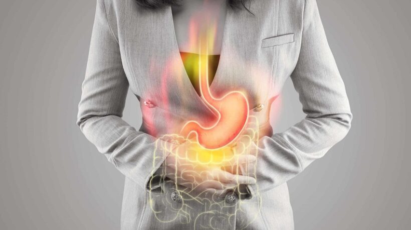 How Do You Treat Stress Ulcers?